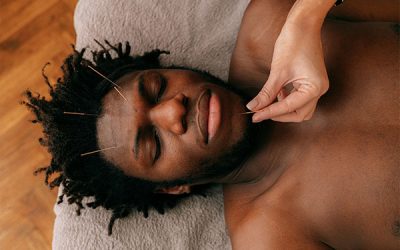 Funny Acupuncture