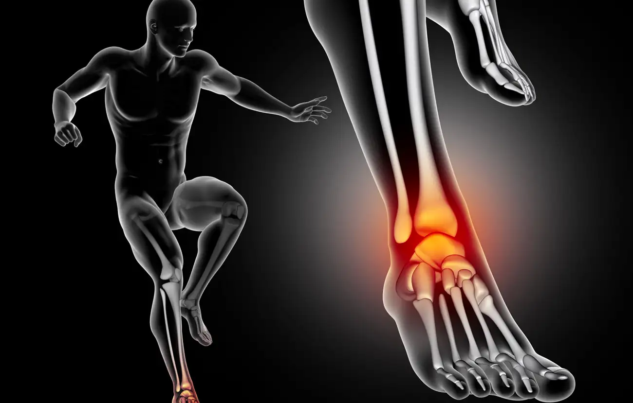 Common running injuries treated at Orthosports Calgary